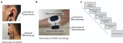 Closed-loop transcutaneous auricular vagus nerve stimulation for the improvement of upper extremity motor function in stroke patients: a study protocol